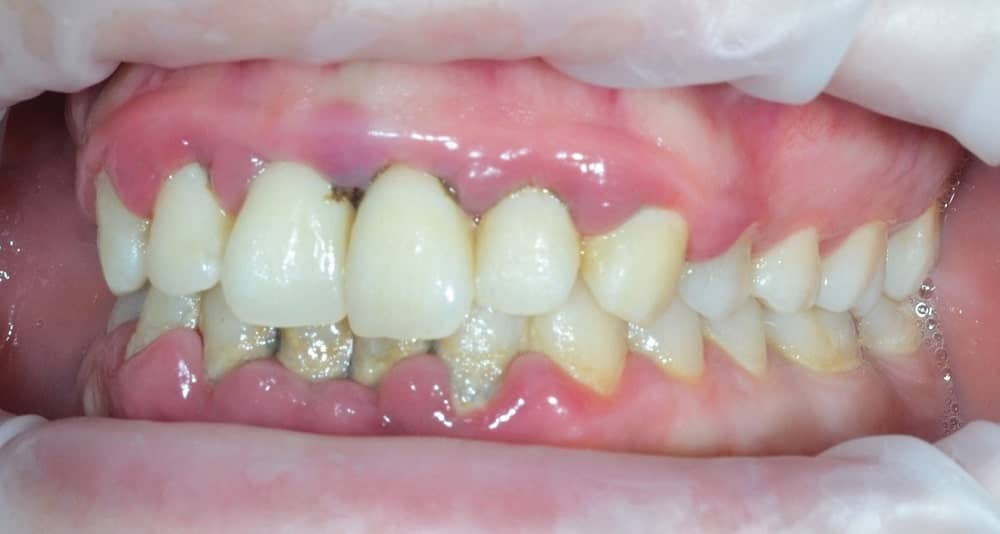 лечение зубов харьков