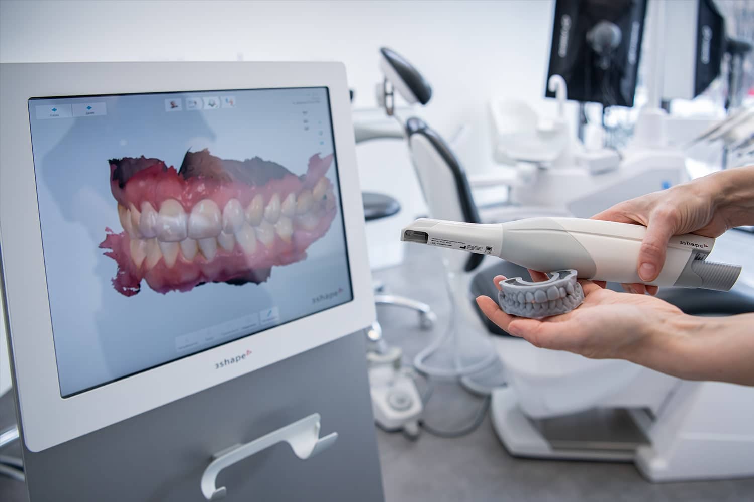 3D сканування зубів
